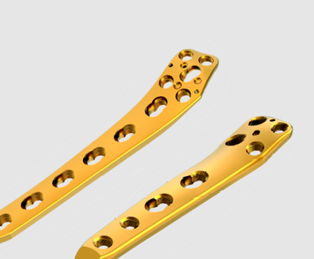 Knee Osteotomy Plates