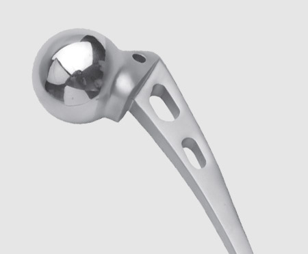 Hip Prosthesis