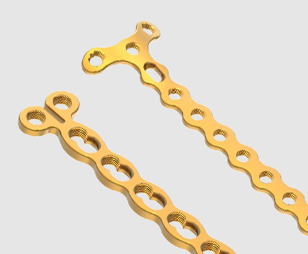 Mini Fragment Implants