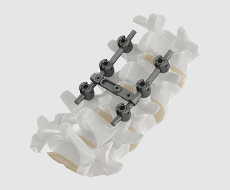 Spine Surgery