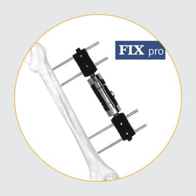 Dynamic Axial Fixators