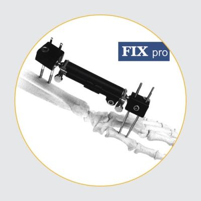Standard & Radiolucent Fixators